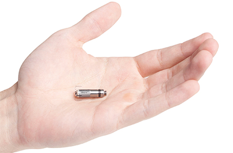 Holy Cross Hospital Offers the World's Smallest Pacemaker